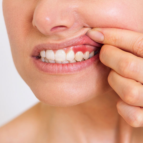 dentistry Palo Alto periodontal disease