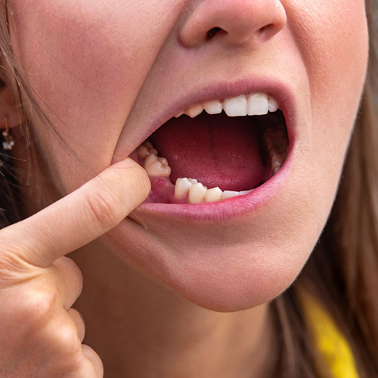 dental implants Palo Alto