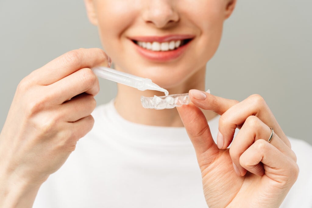 teeth whitening trays Palo Alto cosmetic dentistry