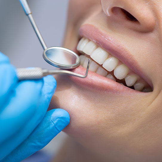 dental cleanings Palo Alto dental cleanings Palo Alto
