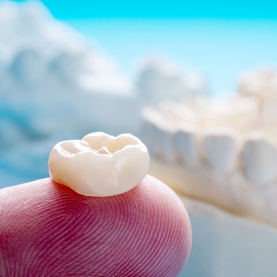 dental crowns Palo Alto