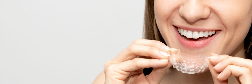 Invisalign Palo Alto Invisalign timeline