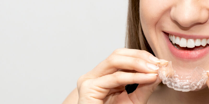 Invisalign Palo Alto Invisalign timeline