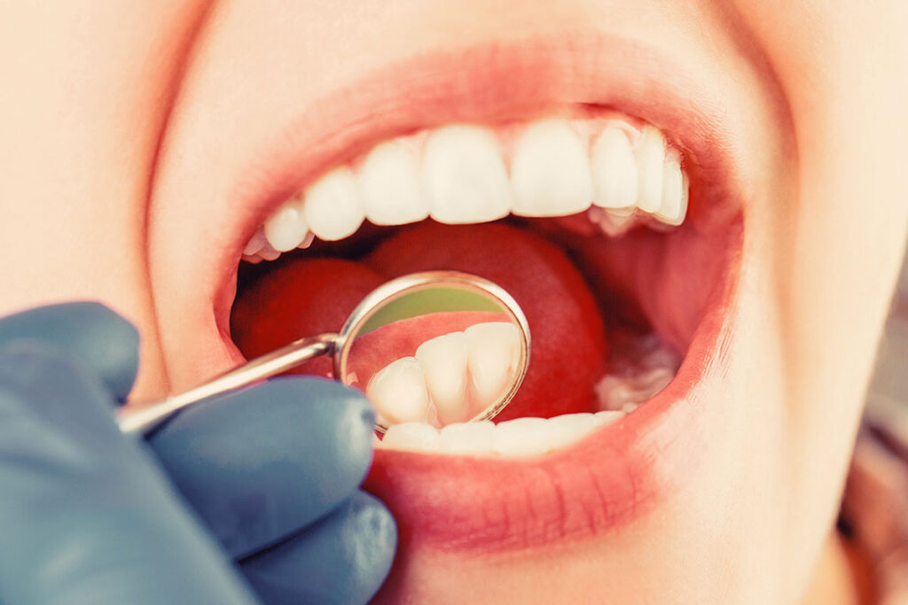 services dentists in Palo Alto